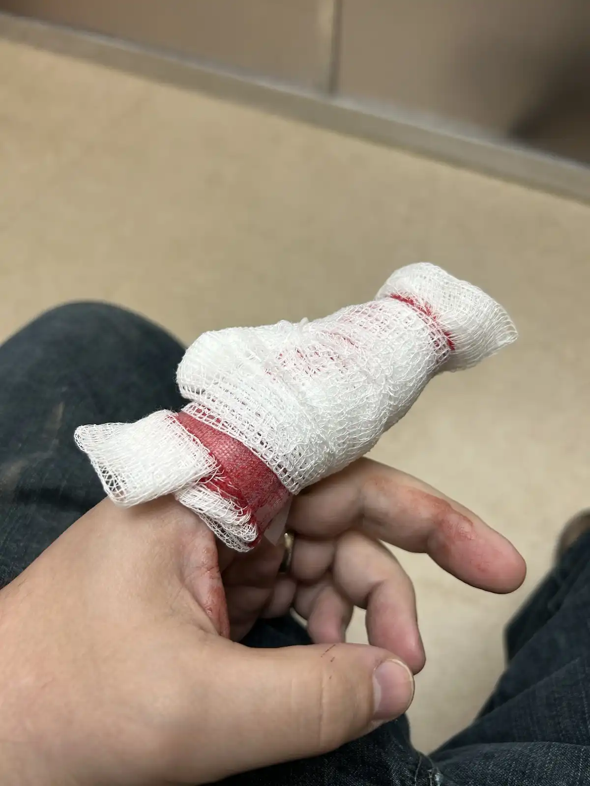 A close-up photo shows a person's hand with their index finger heavily wrapped in white gauze bandages, stained with red…