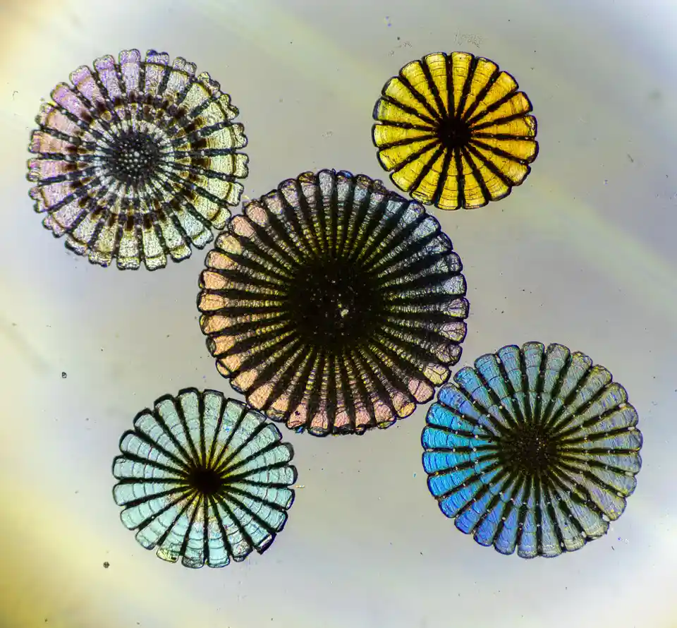 Incredible Close-Up: Sea Urchin Spines Magnified 40 Times