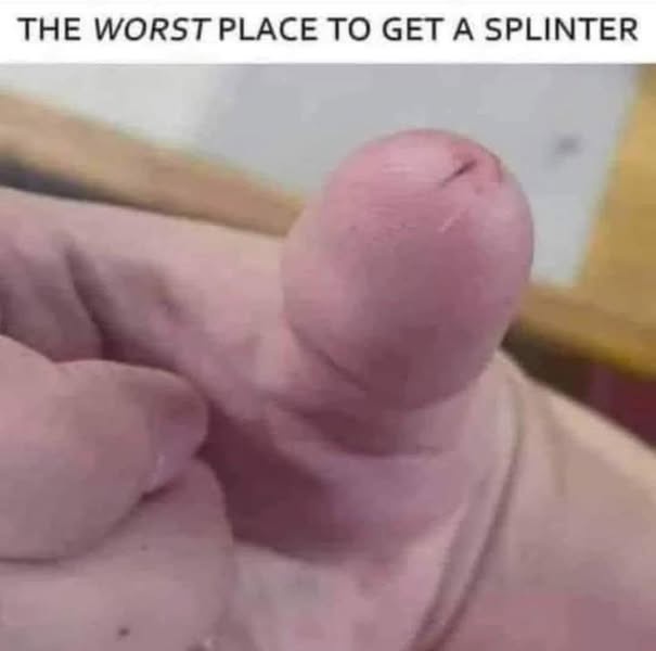 A close-up photo shows the tip of a human toe with a small, visible splinter embedded in the skin. The toe is slightly…