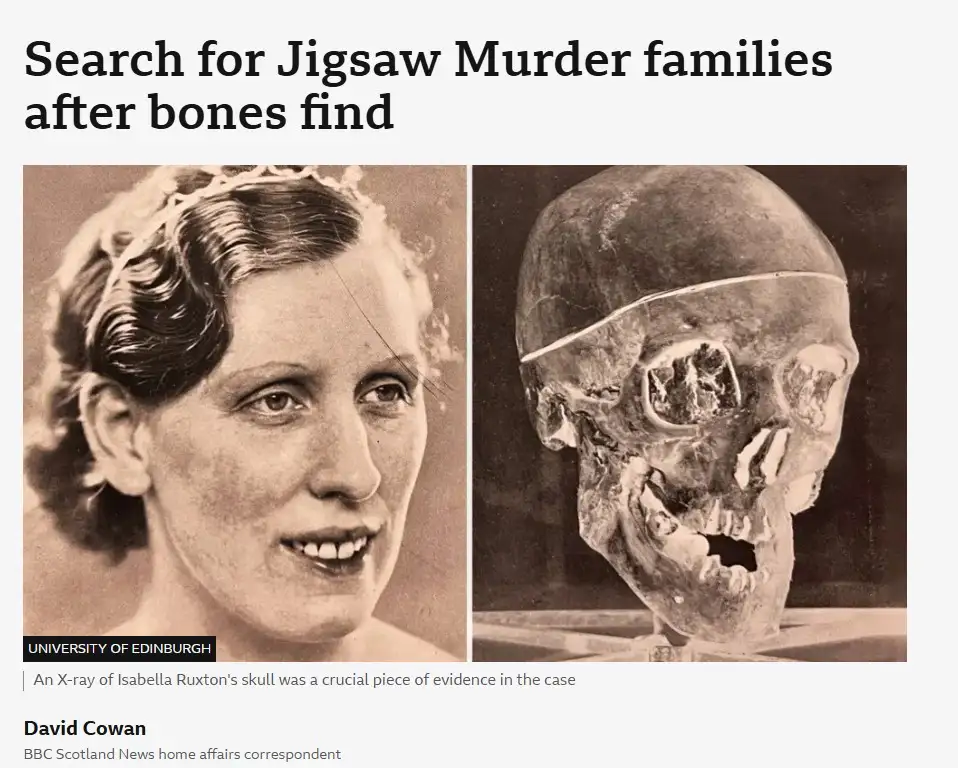 A newspaper article layout shows a vintage photo of a smiling woman next to a damaged skull with visible trauma. The…