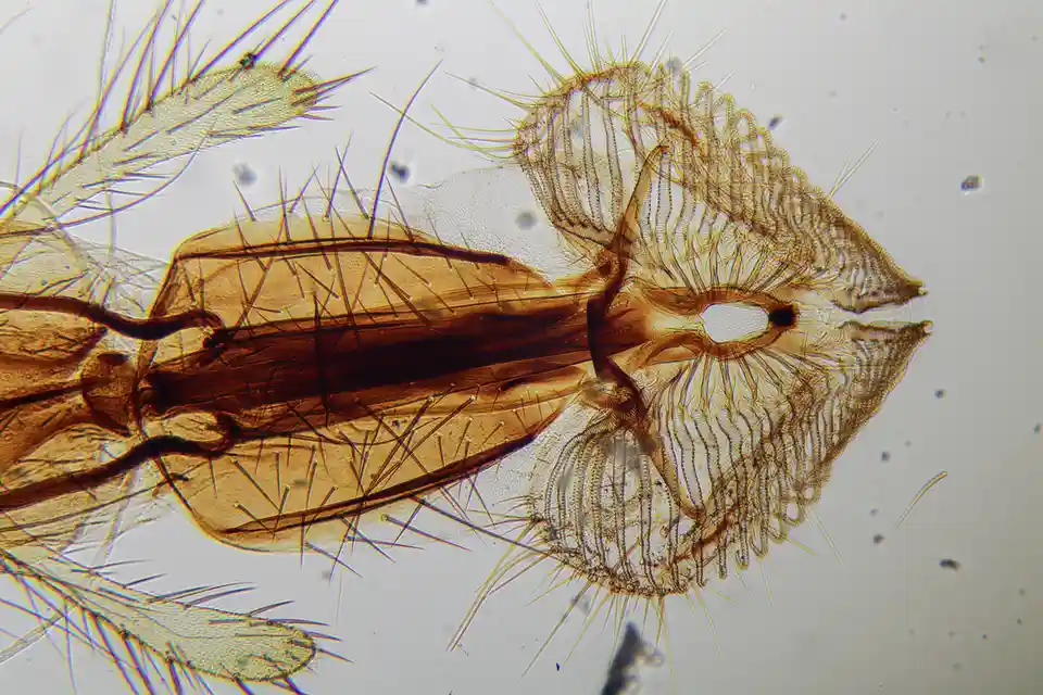 A microscopic close-up of an insect's head and thorax, showing intricate, translucent brown structures with fine hairs and a…