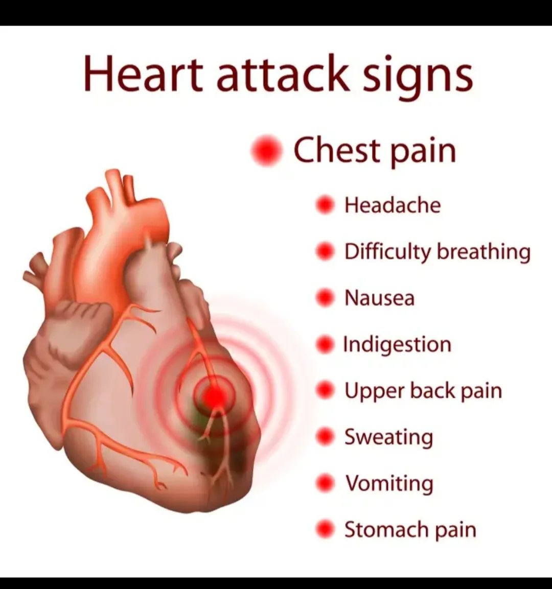 An infographic titled 'Heart attack signs' displays a diagram of a human heart with red concentric circles indicating pain…